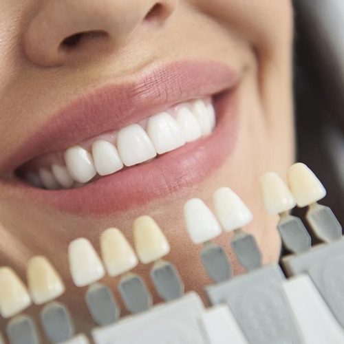 Hammaste fotovalgendus koolitus